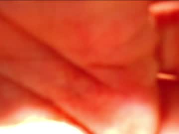 man sextwinksx capture image #4446124